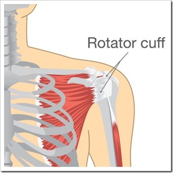 Shoulder Pain Eatonton GA Rotator Cuff Injury