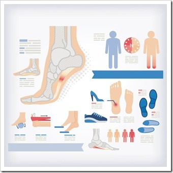 Foot Pain Eatonton GA Plantar Fasciitis